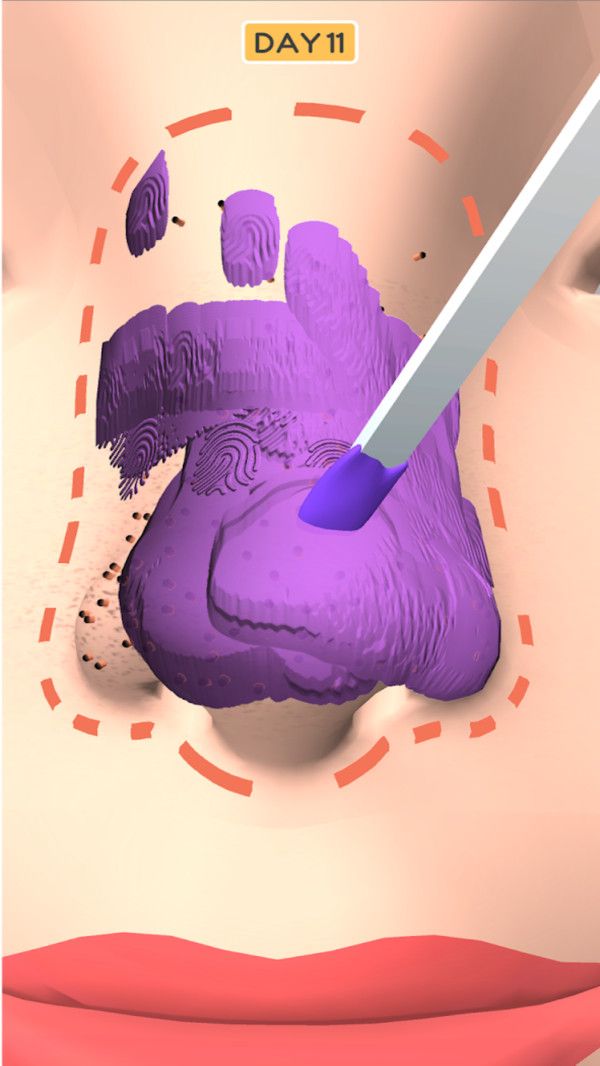 鼻子美容师安卓版游戏截图