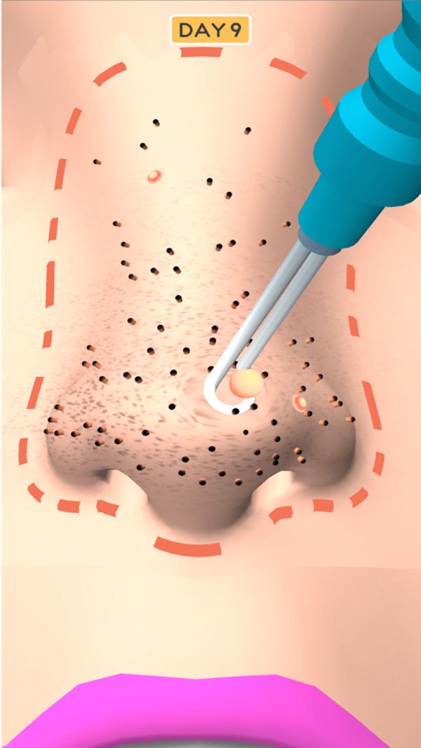 鼻子干净安卓版游戏截图