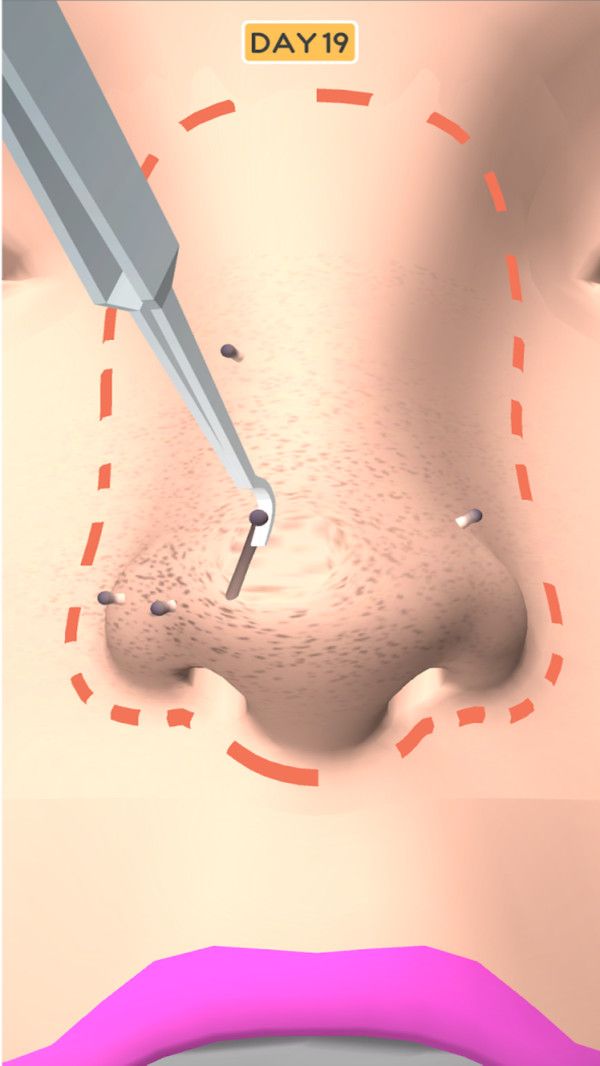 鼻子干净安卓版游戏截图