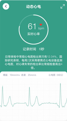 星脉ECG官网版软件截图